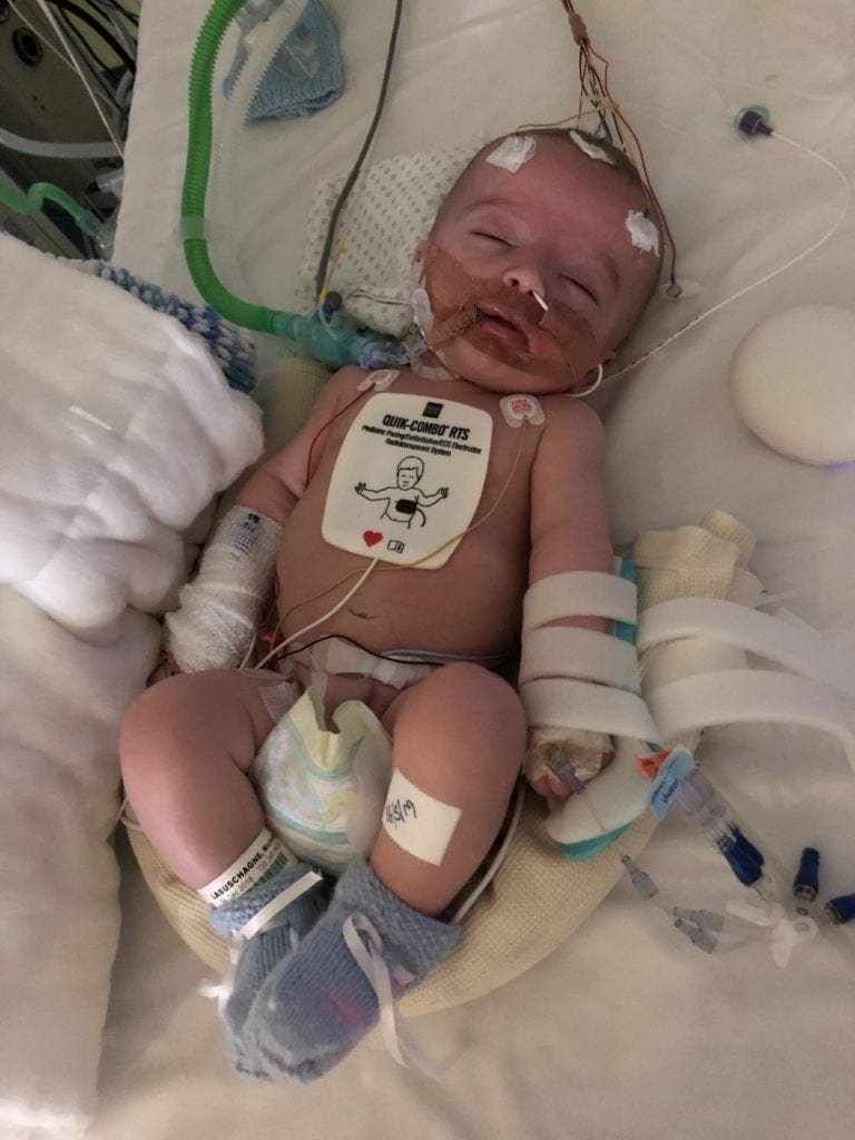 14-week-old baby wakes up after 5-day coma and smiles beautifully right at dad in magical moment