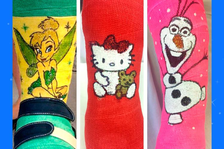 California hospital tech brings smiles to kids' faces with with his famous cast art (Children's Hospital L.A.)